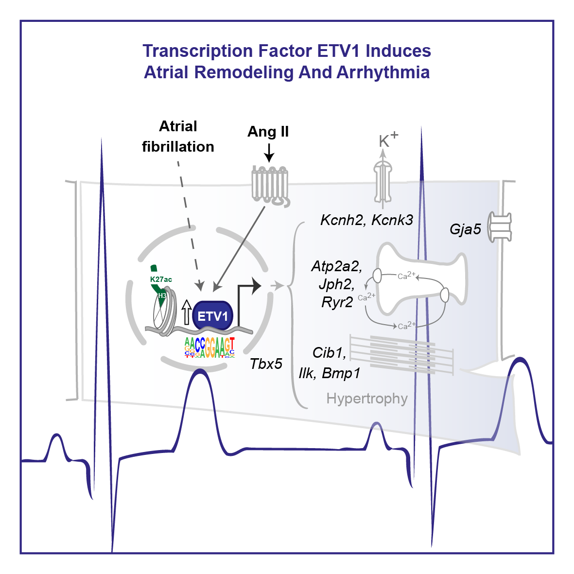 The Transcription Factor ETV1 Induces Atrial Remodeling and Arrhythmia